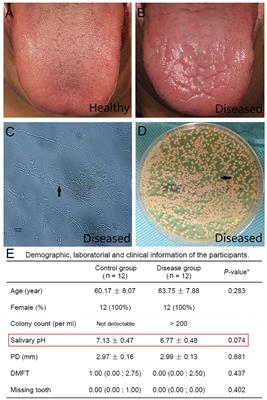 Frontiers | Oral Microbiota Composition and Function Changes During Chronic  Erythematous Candidiasis